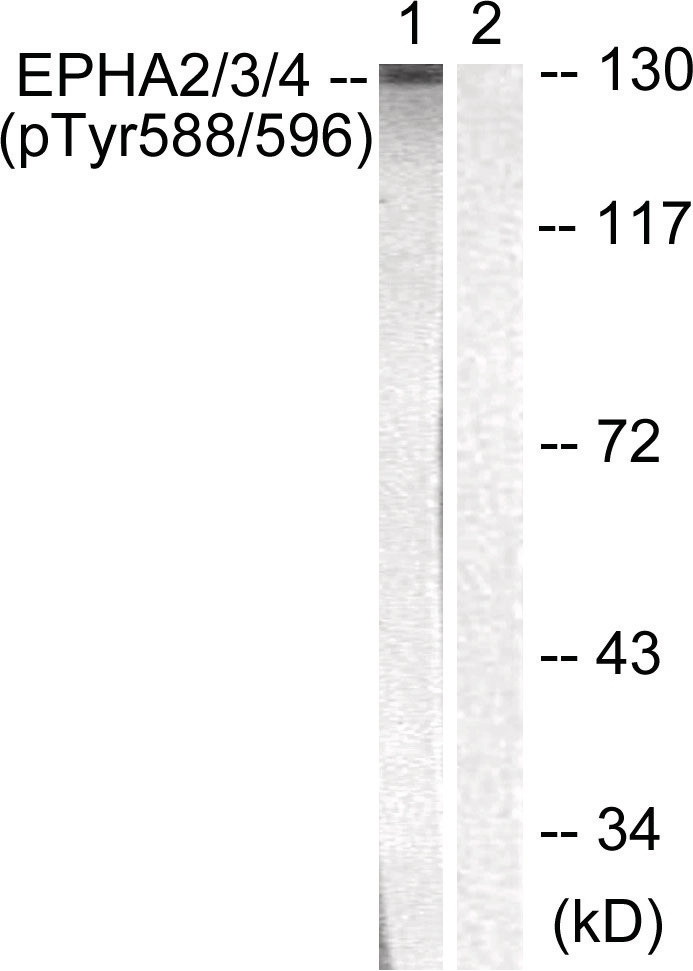 EPHA 2/3/4 (phospho Tyr588/596) Antibody