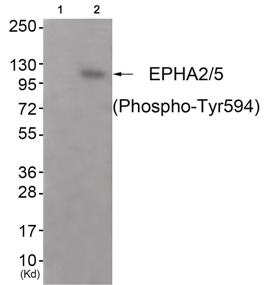 EPHA2/5 (phospho Tyr594) Antibody