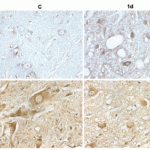 <strong>Figure 10  Immunohistochemistry Validation of EndoG translocation in Rat Spinal Cord Tissue (Yu et al., 2006) </strong><br>Protein analysis for EndoG translocation by immunohistochemistry with anti-EndoG antibodies in Rat spinal cord tissue.  The staining showed that EndoG was expressed in the nuclei of SCI rats (1d) as compared to the perikarya (cytoplasm) in WT.