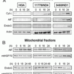 <strong>Figure 8  Localization Validation of EndoG in LHON cybrids  (Zanna et al., 2005) </strong><br>Immunoblots of subcellular fractions enriched for (A) cytosol and (B) mitochondria were used to determine EndoG protein levels with anti-EndoG antibodies in LHON cybrids. The release of EndoG from mitochondria into the cytosol of 3460/ND1 mutant is observed after 24hr. Control (HGA) was unaffected.