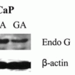 <strong>Figure 11  Translocation of EndoG by α-chaconine (CHA) and gallic acid (GA) in Human Prostate Cancer Cells  (Reddivari et al., 2010) </strong><br>Lymph-node carcinoma of the prostate (LNCaP) or prostate cancer-3 (PC-3) cells were treated with CHA (2.5 μg/ml) or GA (15 μg/ml) for 24hr. EndoG expression detected by anti-EndoG antibodies was increased significantly in nuclear fraction after  CHA or GA treatments while this effect was not observed in the solvent control (C).