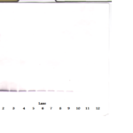 To detect hEndostatin by Western Blot analysis this antibody can be used at a concentration of 0.1 - 0.2 ug/ml. Used in conjunction with compatible secondary reagents the detection limit for recombinant hEndostatin is 1.5 - 3.0 ng/lane, under either reducing or non-reducing conditions.