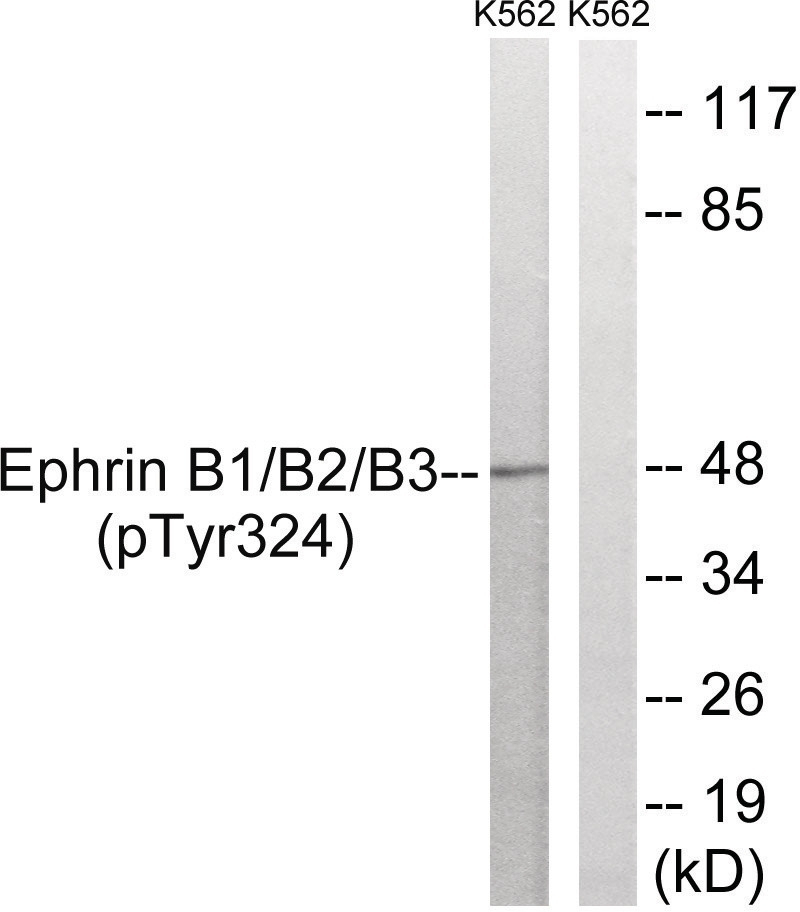 Ephrin B1/B2/B3 (phospho Tyr324) Antibody