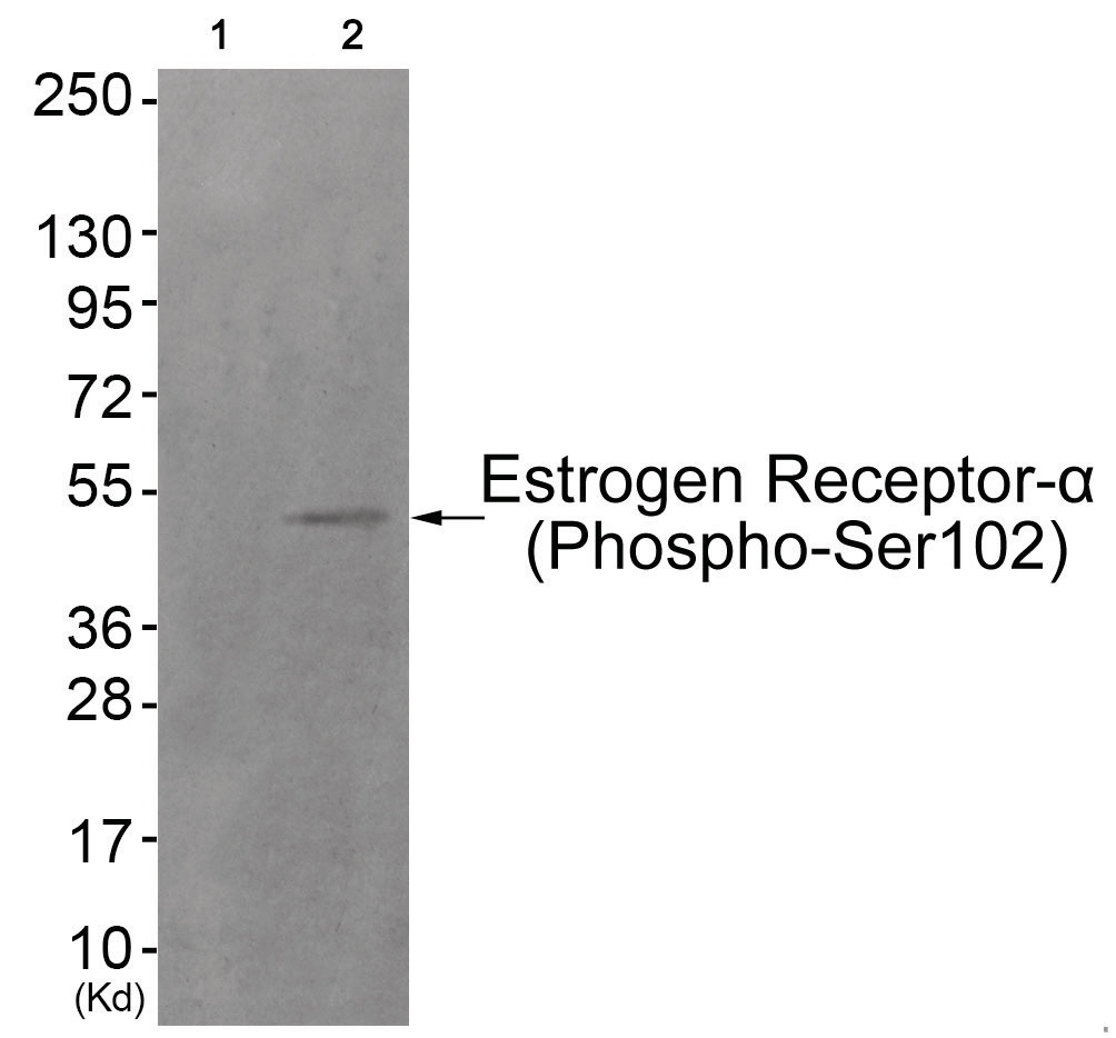 Estrogen Receptor-alpha (phospho Ser102) Antibody