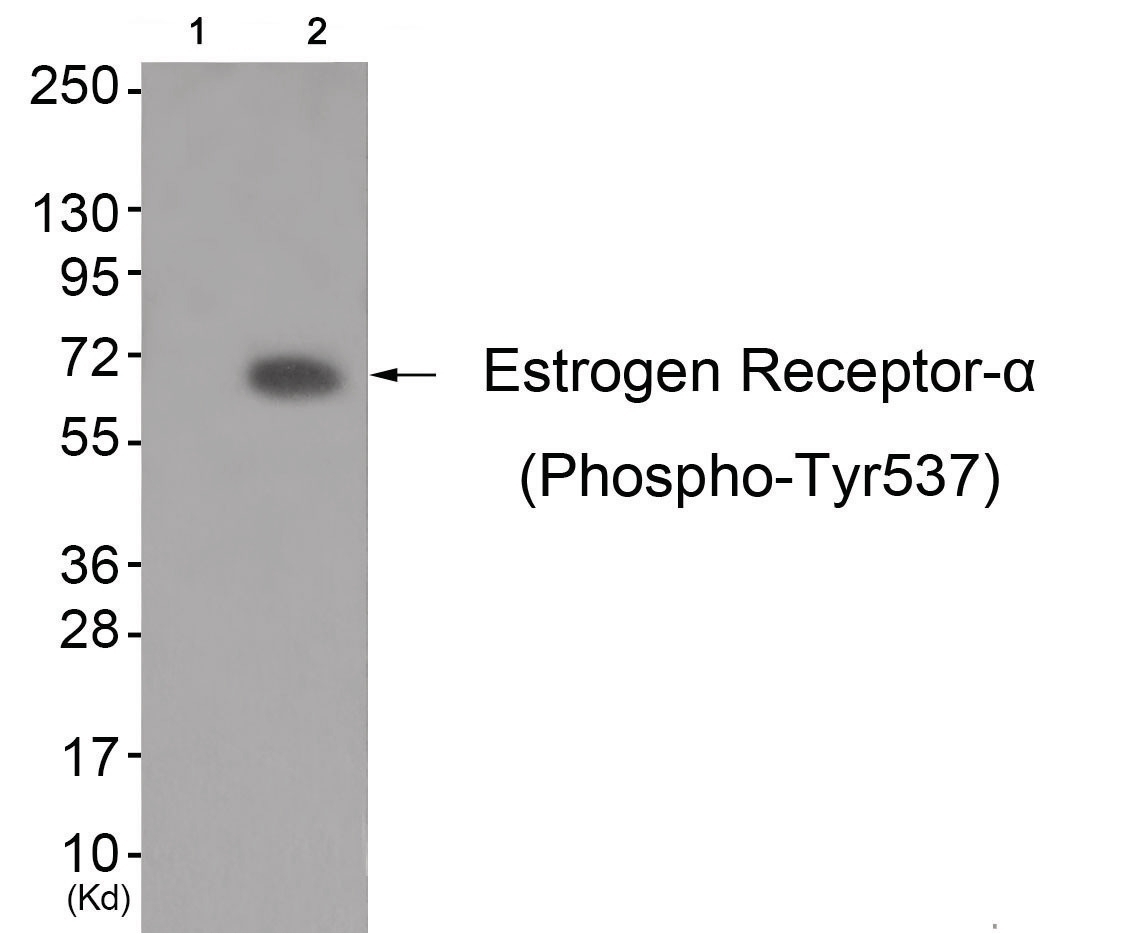 Estrogen Receptor-alpha (phospho Tyr537) Antibody