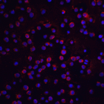 Immunofluorescence of FLIP in Jurkat cells with FLIP antibody at 20 μg/mL.<br><br>Red: FLIP Antibody (2055) <br> Blue: DAPI staining
