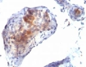 FOXP3 Antibody [FXP3/197]