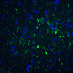 Immunofluorescence of FOXP3 in human brain tissue with FOXP3 antibody at 20 μg/mL.<br><br>Green: FOXP3 Antibody (7187) <br> Blue: DAPI staining
