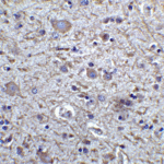Immunohistochemistry of FOXP3 in human brain tissue with FOXP3 antibody at 5 μg/mL.