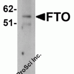 Western blot analysis of FTO in human uterus tissue lysate with FTO antibody at (A) 1 and (B) 2 μg/mL.