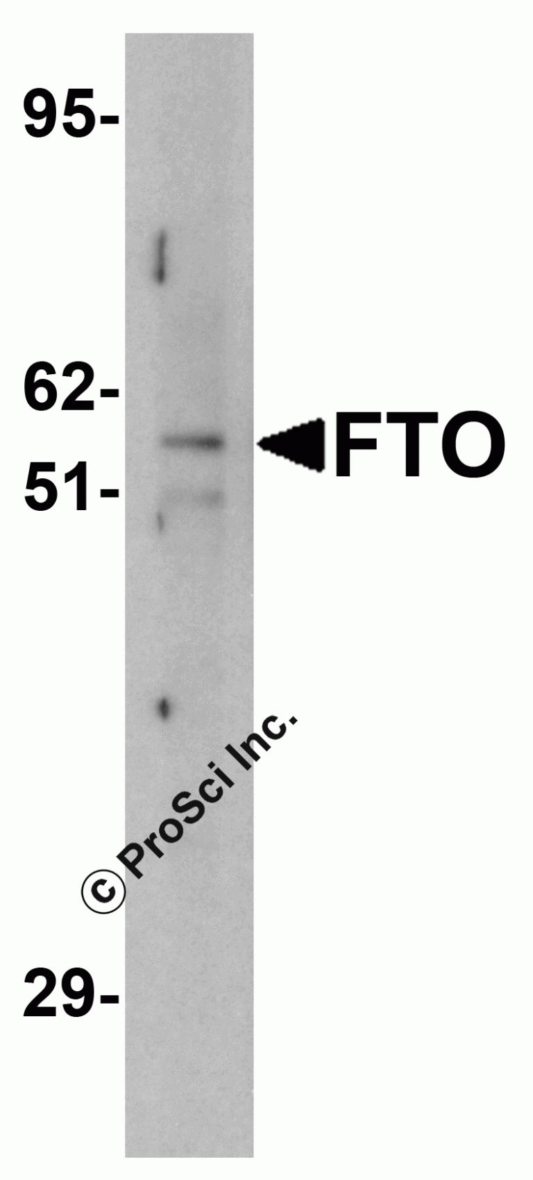FTO Antibody