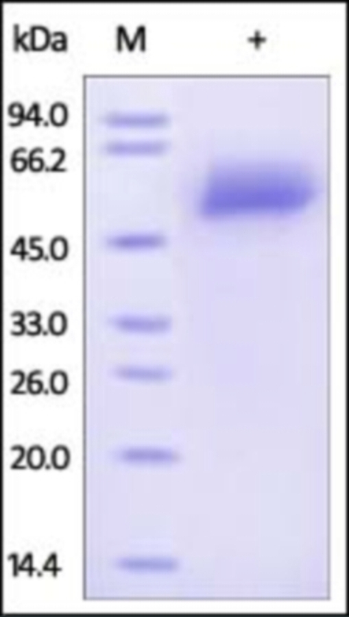 Fetuin A Recombinant Protein
