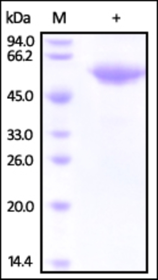 Fetuin B Recombinant Protein