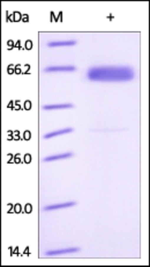 Frizzled 4 Recombinant Protein