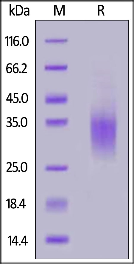 GCGR / Glucagon receptor Recombinant Protein