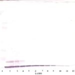 To detect hGCP-2 by Western Blot analysis this antibody can be used at a concentration of 0.1-0.2 ug/ml. Used in conjunction with compatible secondary reagents the detection limit for recombinant hGCP-2 is 1.5-3.0 ng/lane, under either reducing or non-reducing conditions.