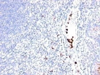 GCSF Antibody [SPM468]