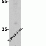 Western blot analysis of GLIS2 in C2C12 cell lysate with GLIS2 antibody at 1 μg/ml in (A) the absence and (B) the presence of blocking peptide.