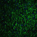 <strong>Figure 6 Immunofluorescence Validation of GLS2 in Mouse Brain</strong><br>Immunofluorescent analysis of 4% paraformaldehyde-fixed mouse brain labeling GLS2 with 6217 at 20 μg g/mL, followed by goat anti-rabbit IgG secondary antibody at 1/500 dilution (green) and DAPI antibody (blue).