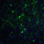 Immunofluorescence of GLUL in mouse brain tissue with GLUL antibody at 20 μg/mL.