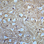 Immunohistochemistry of GLUL in mouse brain tissue with GLUL antibody at 5 μg/mL.