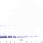 To detect Rat GM-CSF by Western Blot analysis this antibody can be used at a concentration of 0.1 - 0.2 mg/ml. When used in conjunction with compatible development reagents the detection limit for recombinant Rat GM-CSF is 1.5 – 3.0 ng/lane, under either reducing or non-reducing conditions.