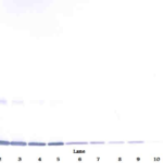 To detect Rat GM-CSF by Western Blot analysis this antibody can be used at a concentration of 0.1 - 0.2 ug/ml. Used in conjunction with compatible secondary reagents the detection limit for recombinant Rat GM-CSF is 1.5 - 3.0 ng/lane, under either reducing or non-reducing conditions.