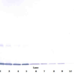 To detect Rat GM-CSF by Western Blot analysis this antibody can be used at a concentration of 0.1 - 0.2 mg/ml. When used in conjunction with compatible development reagents the detection limit for recombinant Rat GM-CSF is 1.5 – 3.0 ng/lane, under either reducing or non-reducing conditions.