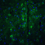 Immunofluorescence of GPAT1 in mouse brain tissue with GPAT1 antibody at 20 μg/mL. <br><br>Green: GPAT1 Antibody (4613) <br> Blue: DAPI staining