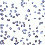 Immunocytochemistry of GPR15 in A431 cells with GPR15 antibody at 5 μg/ml.