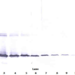 To detect hGalectin-3 by Western Blot analysis this antibody can be used at a concentration of 0.1 - 0.2 ug/ml. Used in conjunction with compatible secondary reagents the detection limit for recombinant hGalectin-3 is 1.5 - 3.0 ng/lane, under either reducing or non-reducing conditions.