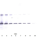 To detect hGalectin-3 by Western Blot analysis this antibody can be used at a concentration of 0.1 - 0.2 ug/ml. Used in conjunction with compatible secondary reagents the detection limit for recombinant hGalectin-3 is 1.5 - 3.0 ng/lane, under either reducing or non-reducing conditions.
