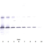 To detect hGalectin-3 by Western Blot analysis this antibody can be used at a concentration of 0.1 - 0.2 ug/ml. Used in conjunction with compatible secondary reagents the detection limit for recombinant hGalectin-3 is 1.5 - 3.0 ng/lane, under either reducing or non-reducing conditions.