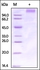 Ebolavirus Glycoprotein Recombinant Protein