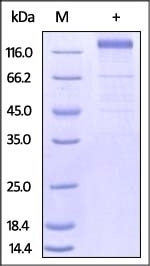 Cytomegalovirus Glycoprotein Recombinant Protein