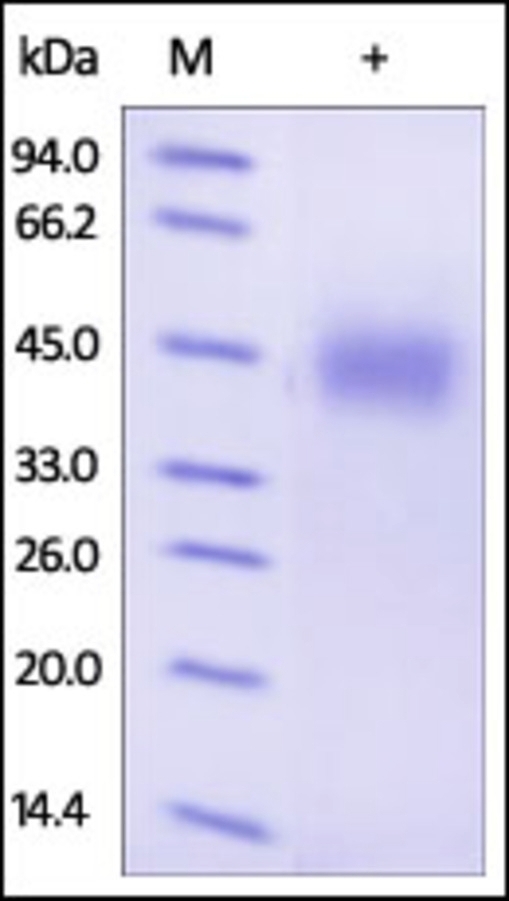Growth Hormone Receptor Recombinant Protein