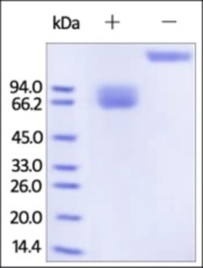 Growth Hormone Receptor Recombinant Protein