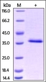 HABP1 Recombinant Protein