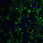 Immunofluorescence of HES5 in mouse brain tissue with HES5 Antibody at 20 μg/mL.<br><br>Green: HES5 Antibody (8055) <br> Blue: DAPI staining