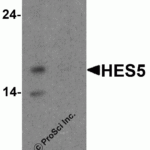 Western blot analysis of HES5 in Raji cell lysate with HES5 antibody at 1 μg/ml (A) the absence and (B) the presence of blocking peptide.