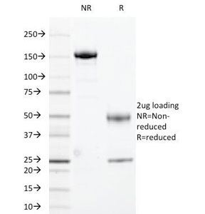 HLA-DR Antibody [169-1B5.2]