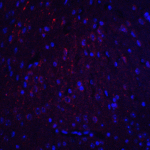 Immunofluorescence of HOOK3 in mouse brain tissue with HOOK3 antibody at 20 μg/ml.<br><br>Red: HOOK3 Antibody (8425) <br> Blue: DAPI staining
