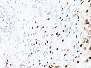 HPV-16 Antibody [SPM405]
