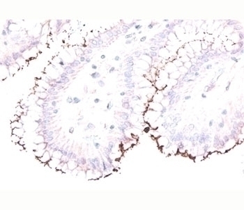 Helicobacter Pylori Antibody