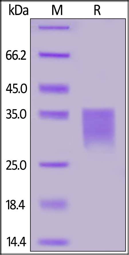 Her2 / ErbB2 (498-648) Recombinant Protein