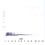 To detect Human Heregulin-beta1 by Western Blot analysis this antibody can be used at a concentration of 0.1 - 0.2 ug/ml. When used in conjunction with compatible secondary reagents, the detection limit for recombinant Human Heregulin-beta1 is 1.5 - 3.0 ng/lane, under either reducing or non-reducing conditions.