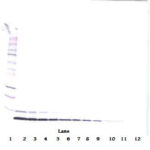 To detect Human Heregulin-beta1 by Western Blot analysis this antibody can be used at a concentration of 0.1 - 0.2 ug/ml. When used in conjunction with compatible secondary reagents, the detection limit for recombinant Human Heregulin-beta1 is 1.5 - 3.0 ng/lane, under either reducing or non-reducing conditions.