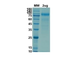 Human ACE2 Recombinant Protein