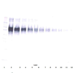 To detect Human ICAM-1 by Western Blot analysis this antibody can be used at a concentration of 0.1 - 0.2 ug/ml. Used in conjunction with compatible secondary reagents the detection limit for recombinant Human ICAM-1 is 1.5 - 3.0 ng/lane, under either reducing or non-reducing conditions.