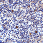 Immunohistochemistry of ICOSLG in human lymph node tissue with ICOSLG antibody at 2 μg/ml.